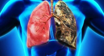 Lungs Health : ఈ ఆహారాలను తీసుకుంటున్నారా.. ఊపిరితిత్తులకు ఎంతో హాని చేస్తాయి జాగ్రత్త..!
