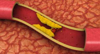 Health Tips : ర‌క్త నాళాల్లో ఉండే అడ్డంకులు తొల‌గిపోయి ఆరోగ్యంగా ఉండాలంటే.. వీటిని తీసుకోవాలి..