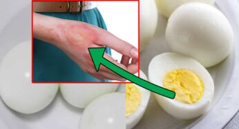 Food Combinations : కోడిగుడ్ల‌ను తిన్న త‌రువాత ఎట్టి ప‌రిస్థితిలోనూ వీటిని తీసుకోకండి..!