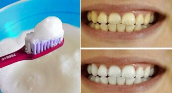 Teeth : ఈ చిట్కాల‌ను పాటిస్తే.. ప‌సుపు రంగులోని దంతాలు తెల్ల‌గా మారుతాయి..!