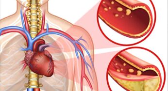 Cholesterol Levels : శ‌రీరంలోని కొలెస్ట్రాల్ మొత్తం క‌రిగిపోవాలంటే.. ఇవి అద్భుతంగా ప‌నిచేస్తాయి..!