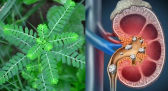 Kidney Stones : కిడ్నీల్లోని రాళ్ల‌ను క‌రిగించే మొక్క ఇది.. ఎక్క‌డ క‌నిపించినా వ‌ద‌లొద్దు..!