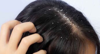 Dandruff : చుండ్రు స‌మ‌స్య‌ను త‌గ్గించే అద్భుత‌మైన చిట్కాలు..!