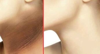 Blackness On Neck : మీ మెడ భాగం తెల్లగా అవ్వాలంటే.. ఇలా చేయండి..