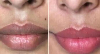 దీన్ని రాస్తే.. న‌ల్ల‌గా ఉన్న పెద‌వులు చ‌క్క‌ని గులాబీ రంగులోకి మారుతాయి..!