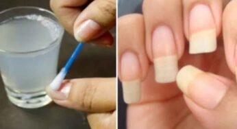 Nails : మీ గోర్లు అందంగా మారి పొడ‌వుగా పెర‌గాలంటే.. ఇలా చేయాలి..