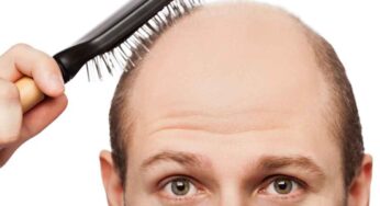 Bald Head : పురుషులు ఈ త‌ప్పులు చేస్తున్నారా.. అయితే బ‌ట్ట‌త‌ల గ్యారంటీగా వ‌స్తుంది జాగ్ర‌త్త‌..