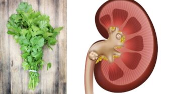 Coriander Leaves : కొత్తిమీర‌తో ఇలా చేస్తే.. కిడ్నీల్లో రాళ్లు మాయం..!