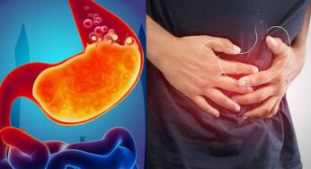 Gas Trouble : మీరు రోజూ తీసుకునే ఈ ఆహారాలే గ్యాస్ స‌మ‌స్య‌ను క‌ల‌గ‌జేస్తున్నాయ‌ని మీకు తెలుసా..?