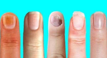 Nails And Health : మీ గోళ్లను బట్టి మీ ఆరోగ్యం తెలుసుకునే చిట్కాలు..!