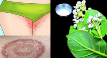 Ringworm : తొడలు, గజ్జల్లో వచ్చే విప‌రీత‌మైన గజ్జి, తామర, దురదను 3 రోజుల్లో మాయం చేసే చిట్కా..!