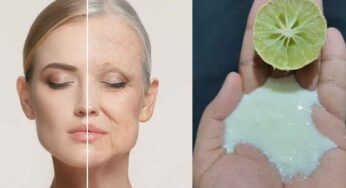 Wrinkles : ముఖంపై ముడ‌త‌ల‌ను త‌గ్గించే అద్భుత‌మైన చిట్కా..!