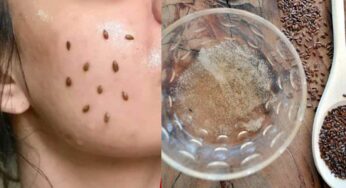 Flaxseeds Gel : రోజూ రాత్రి నిద్ర‌కు ముందు దీన్ని రాస్తే.. ముఖంపై ఎలాంటి మొటిమ‌లు, మ‌చ్చ‌లు, న‌లుపుద‌నం ఉండ‌వు..