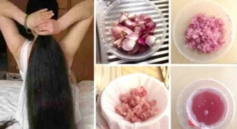 Onion Juice : ఉల్లిపాయ‌ల‌తో నిజంగానే జుట్టు పెరుగుతుందా.. అస‌లు ఇందులో నిజం ఎంత ఉంది..?