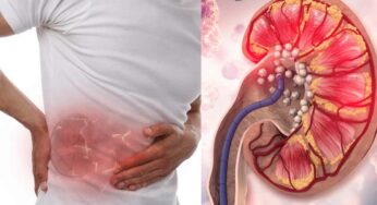 Kidney Stones : కిడ్నీల్లో రాళ్లు అసలు ఎలా వ‌స్తాయి.. వాటిని ఎలా గుర్తించాలి..?