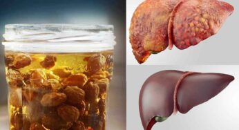 Liver Clean : 15 రోజుల‌కు ఒక‌సారి మీ లివ‌ర్‌ను ఇలా క్లీన్ చేసుకోండి.. ఎలాంటి రోగాలు రావు..!