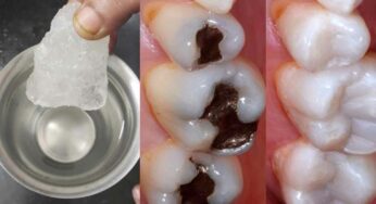 Teeth Pain : పుచ్చిపోయిన దంతాల‌పై ఇలా చేస్తే.. నొప్పి త‌గ్గుతుంది.. దంతాల‌ను పీకించాల్సిన ప‌నిలేదు..!