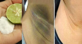 Dark Armpits : ఒక్క‌సారి ఇలా చేస్తే చాలు.. ఎంత‌టి న‌ల్ల‌ని చంక‌లు అయినా స‌రే తెల్ల‌గా మారుతాయి..!