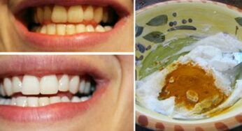 Turmeric For Teeth : ఇలా చేస్తే చాలు.. దంతాల‌పై ప‌ట్టిన గార‌, పసుపుద‌నం పోయి తెల్ల‌గా మెరుస్తాయి..!