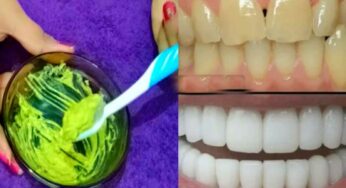 Yellow Teeth : ఎంత‌టి ప‌సుపు దంతాలు అయినా స‌రే.. దీన్ని వాడితే తెల్ల‌గా మార‌డం ఖాయం..!