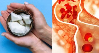 Raw Coconut For Cholesterol : రోజూ ఇది కాస్త చాలు.. కొలెస్ట్రాల్ త‌గ్గుతుంది.. మ‌లం జాడించి కొడుతుంది..!
