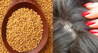 Fenugreek Seeds For Dandruff : మెంతులు, మందార ఆకుల‌తో ఇలా చేస్తే చాలు.. చుండ్రు అన్న‌ది అస‌లు ఉండ‌దు..!