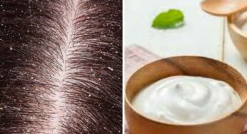 Curd For Hair Fall : పెరుగుతో ఇలా చేస్తే చాలు.. మీ జుట్టు రాల‌దు.. పెరుగుతూనే ఉంటుంది..!