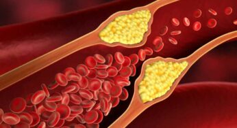 Foods For LDL : చెడు కొలెస్ట్రాల్ ఎక్కువ‌గా ఉందా.. అయితే వీటిని రోజూ తినండి..!