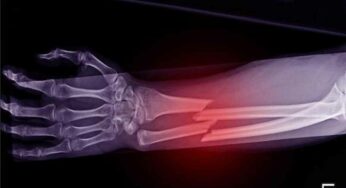 Bones Health : చ‌లికాలంలో వీటిని తింటే మీ ఎముక‌లు సేఫ్‌.. లేదంటే విరిగిపోతాయి జాగ్ర‌త్త‌..!