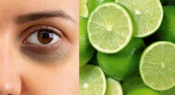 Dark Circles Home Remedies : క‌ళ్ల కింద న‌లుపు త‌గ్గించే టాప్ రెమెడీస్‌.. ఇలా చేయండి చాలు..!