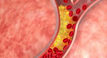 Cholesterol : కొలెస్ట్రాల్ అదుపులో ఉండ‌డం లేదా.. అయితే ఈ అల‌వాట్ల‌ను మానేయాల్సిందే..!