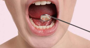 Mouth Cancer Symptoms : ఈ 8 ల‌క్ష‌ణాలు క‌నిపిస్తున్నాయా.. అయితే మీకు నోటి క్యాన్స‌ర్ వ‌చ్చిన‌ట్లే..!