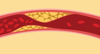 Cholesterol : ఈ నాచుర‌ల్ టిప్స్‌ను పాటిస్తే.. మీ శ‌రీరంలో కొలెస్ట్రాల్ మొత్తం కరిగిపోతుంది..!