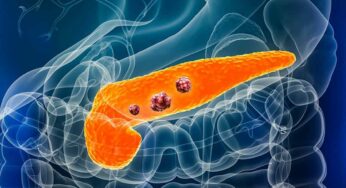 Pancreatic Cancer Symptoms : భోజ‌నం చేసే స‌మ‌యంలో మీకు ఇలా అవుతుందా.. అయితే అది క్యాన్స‌ర్ కావ‌చ్చు.. జాగ్ర‌త్త‌..!