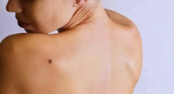 Birth Marks : పుట్టు మ‌చ్చ‌లు శ‌రీరంపై ఎక్క‌డ ఉంటే.. ఎలాంటి ఫ‌లితాలు క‌లుగుతాయో తెలుసా..?
