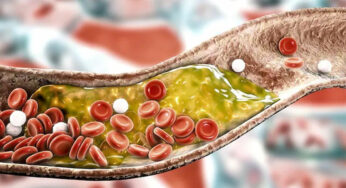 శ‌రీరంలో పేరుకుపోయిన కొవ్వు క‌ర‌గాలంటే ఈ చిట్కాలు పాటించండి..!