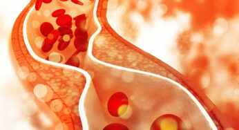 Cholesterol : రోజూ వీటిని 2 స్పూన్లు తీసుకుంటే చాలు.. కొలెస్ట్రాల్ క‌రిగిపోతుంది..!