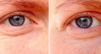 Coconut Oil Under Eyes : రాత్రి నిద్ర‌కు ముందు క‌ళ్ల కింద కొబ్బ‌రినూనె రాయండి.. ఏం జ‌రుగుతుందంటే..?