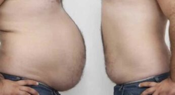 Fat : శ‌రీరంలోని కొవ్వును వేగంగా కరిగించాలంటే.. వీటిని రోజూ తినాలి..!