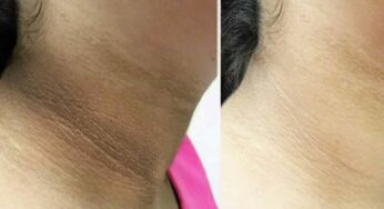 Beauty Tips : మెడ భాగంలో ఉండే నలుపుదనం పోయి తెల్లగా మారాలంటే.. ఇలా చేయాలి..!