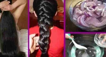 Hair Growth : ఉల్లిపాయ‌ల‌తో ఇలా చేస్తే.. మీ జుట్టు వ‌ద్ద‌న్నా స‌రే పెరుగుతూనే ఉంటుంది..!