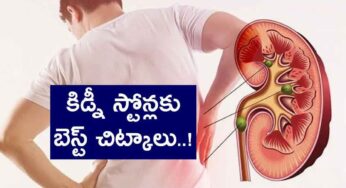 Best Remedies To Remove Kidney Stones : కిడ్నీ స్టోన్లను క‌రిగించేందుకు అద్భుత‌మైన ఇంటి చిట్కాలు..!