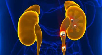 Kidney Stones : కిడ్నీల్లో రాళ్లు ఉన్న‌వారు ఏం తినాలి.. ఏం తినకూడ‌దు..?