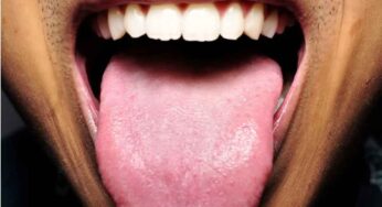 Tongue Spots : నాలుక మీద మచ్చలు ఉంటే.. ఏది చెబితే అది అయిపోతుందా..?