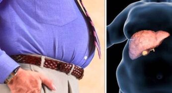 ఫ్యాటీ లివర్ స‌మ‌స్య ఉందా ? ఈ ఆహారాల‌ను తీసుకోండి !