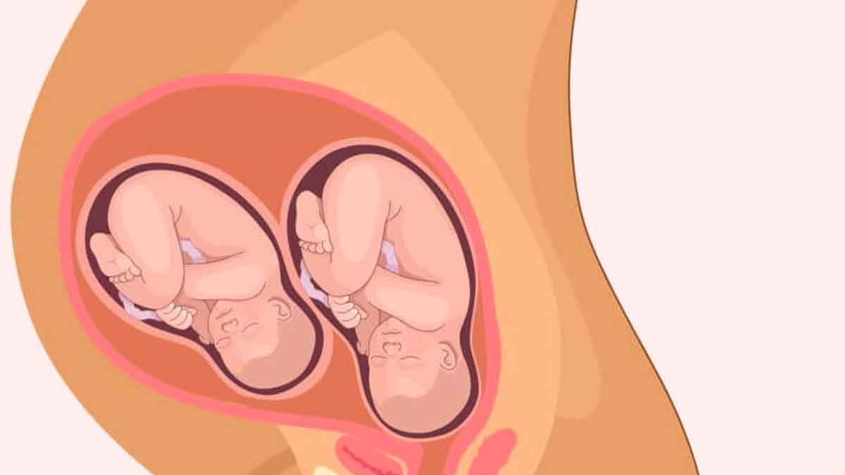 twins in womb what precautions women must take 
