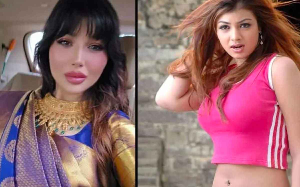 ayesha takia plastic surgery photos viral 