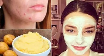 ఆలుగడ్డ‌ల‌తో ఇలా చేస్తే చాలు.. మీ అందం రెట్టింపు అవుతుంది..!