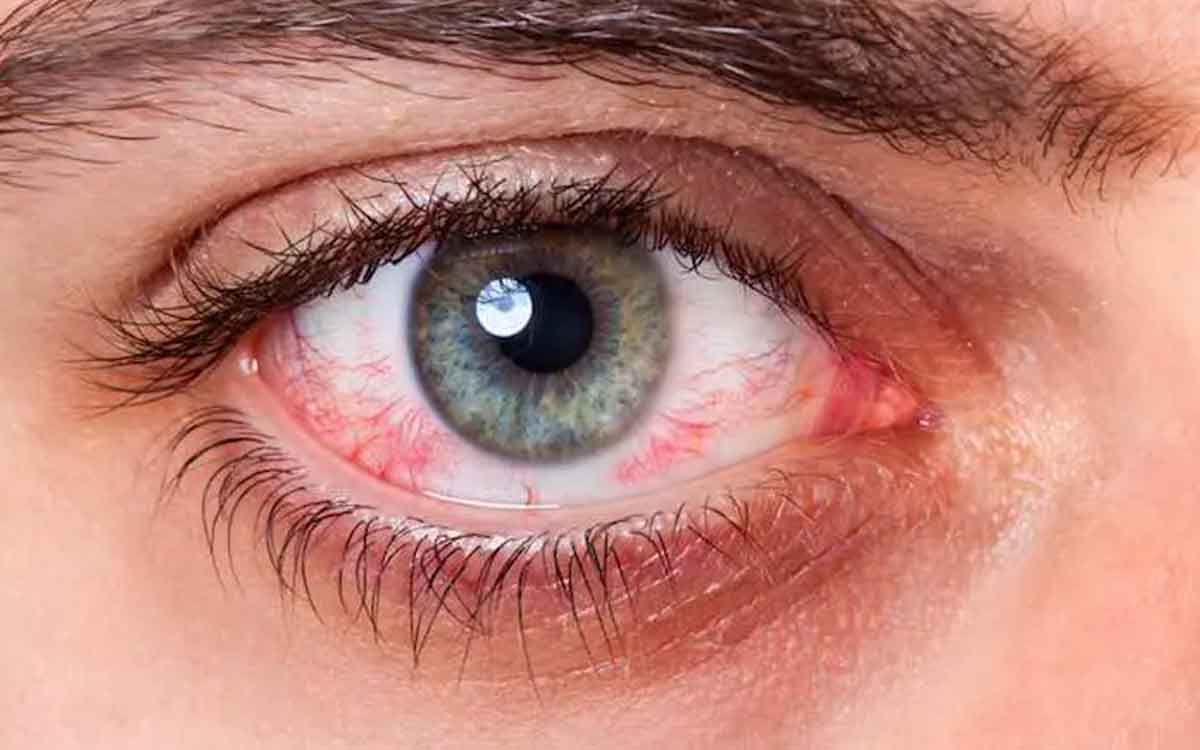 your eyes will tell if you have any diseases 