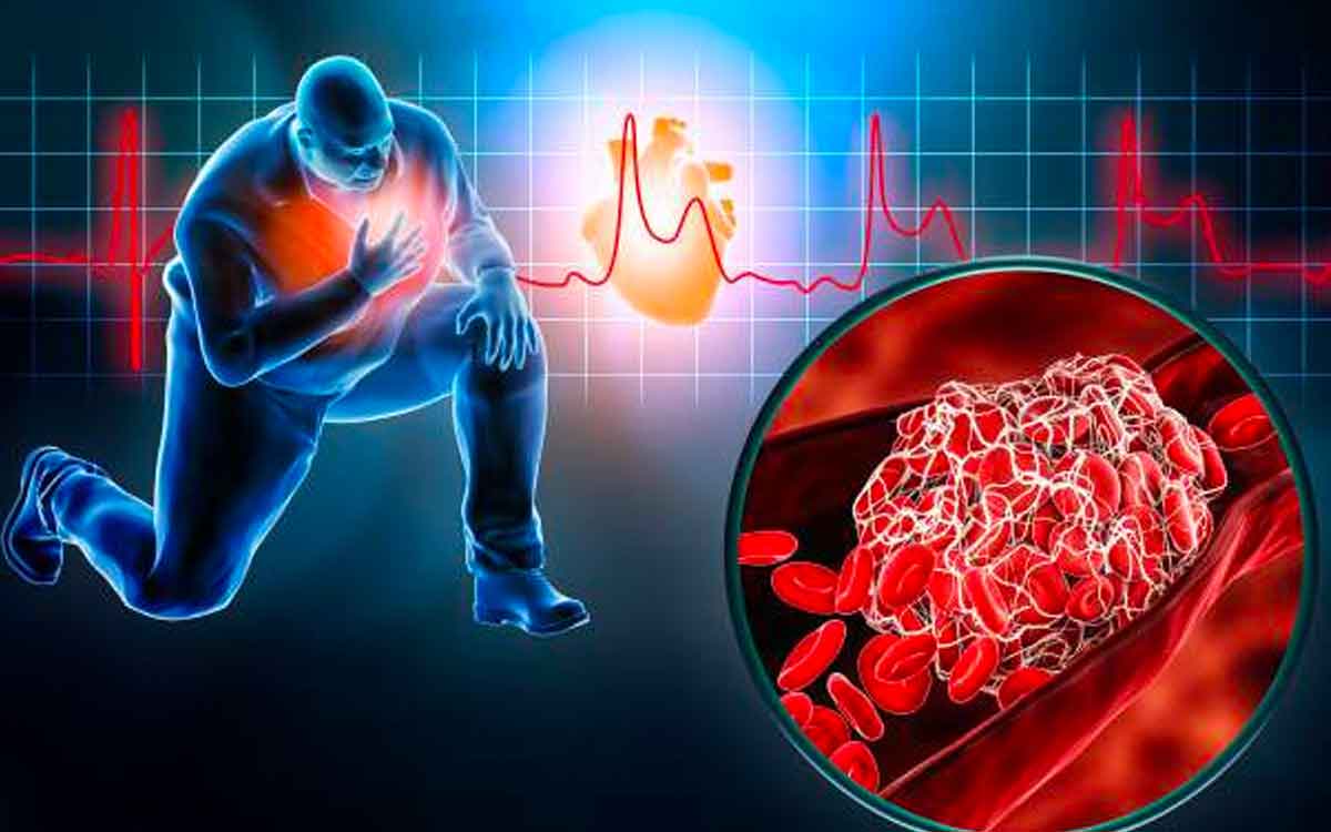 morning time heart attacks are causing more deaths 